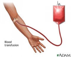 the-blood-transfusion.jpg