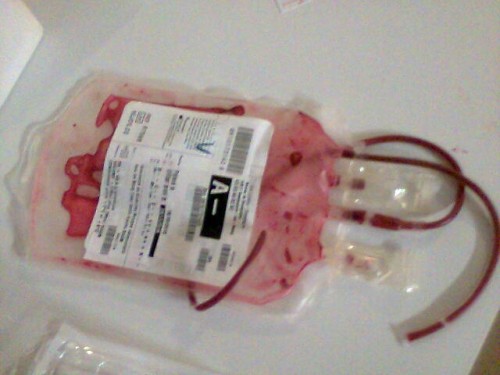 perfusion du 6.11.jpg